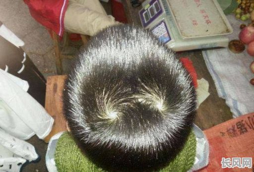 头顶有凹陷的命格男孩，这预示着怎样的命运？他的未来会怎样？