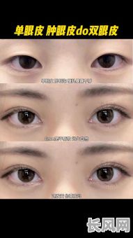 双眼皮命格与单眼皮命格，究竟哪个更佳？