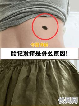 身体胎记的位置究竟预示着怎样的命运？