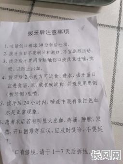 拔牙要看吉日吗-拔牙要挑日子吗