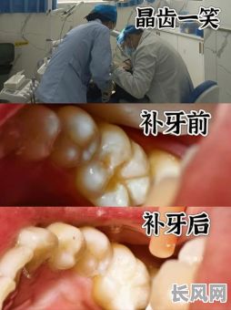 2025年补牙吉日/2020年补牙